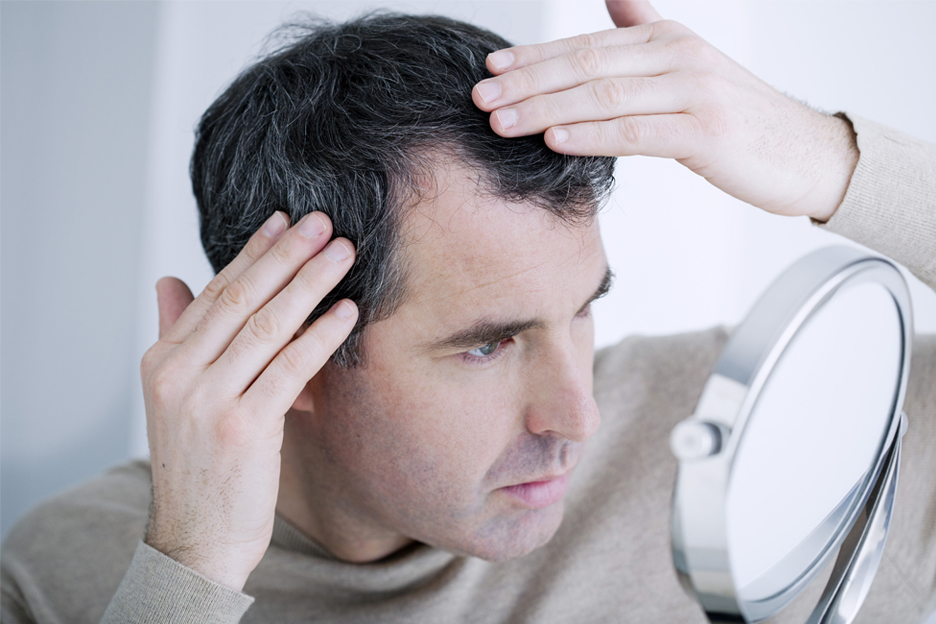 5 mythes sur la perte de cheveux chronique | brunet