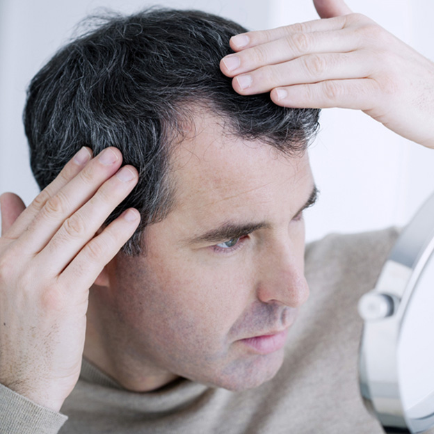 5 Chronic Hair Loss Myths