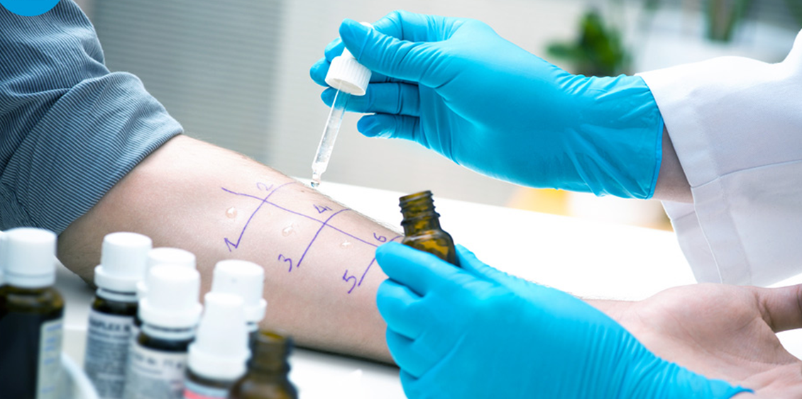 Les allergies graves et l’anaphylaxie