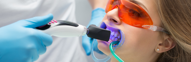Teeth bleaching at the dentist’s office