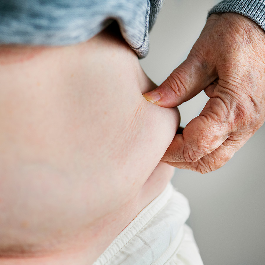 Abdominal Obesity: 4 Winning Strategies!