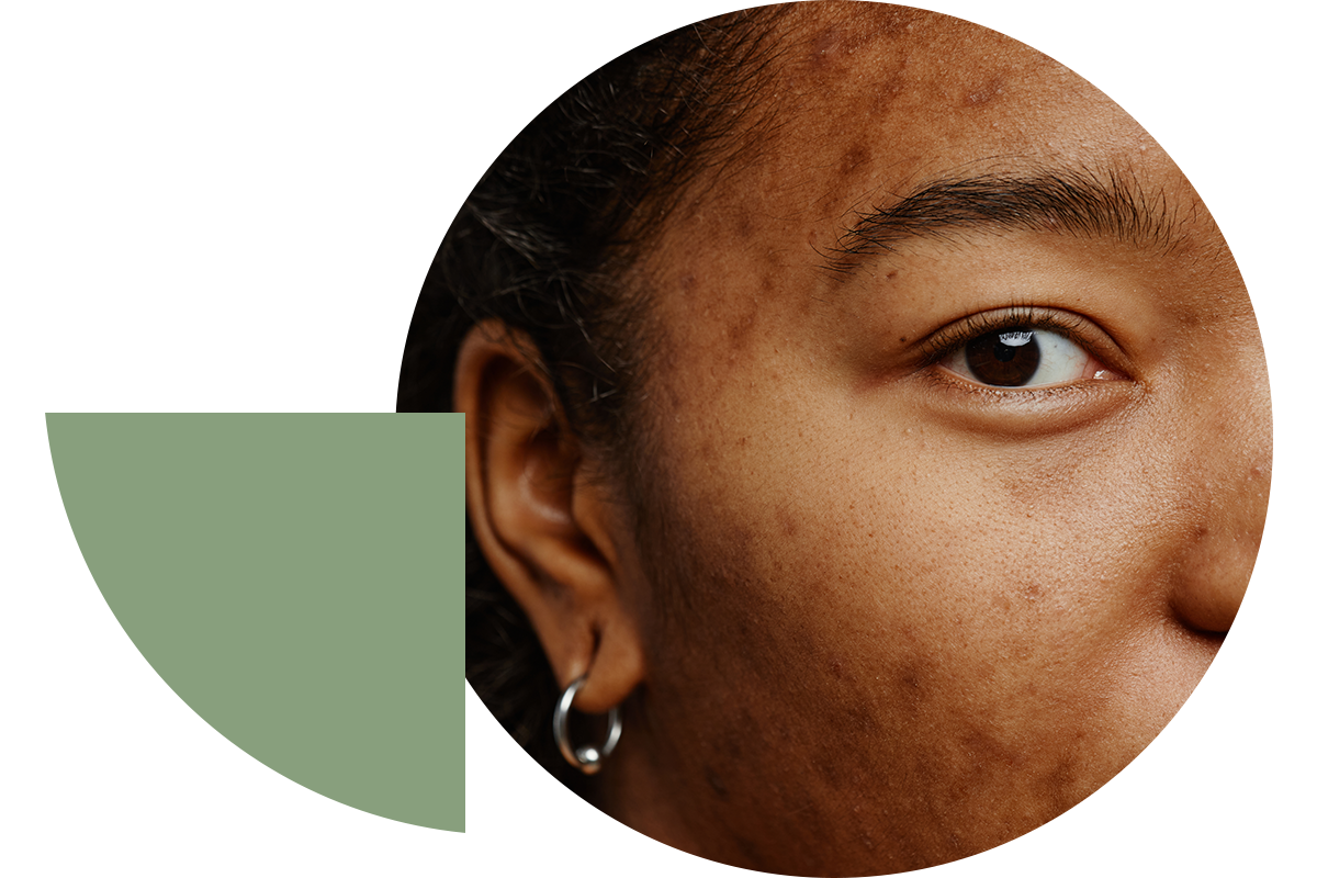 Healthy skin starts here