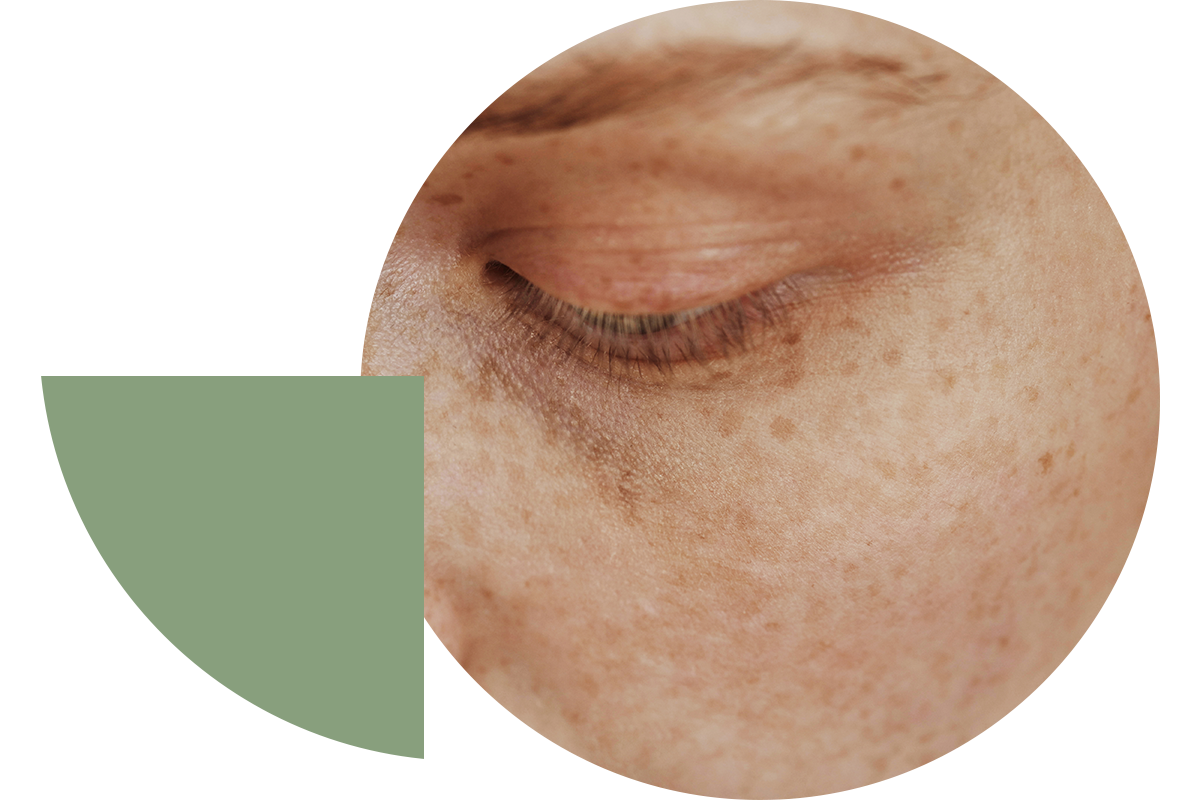 We gently soothe your skin