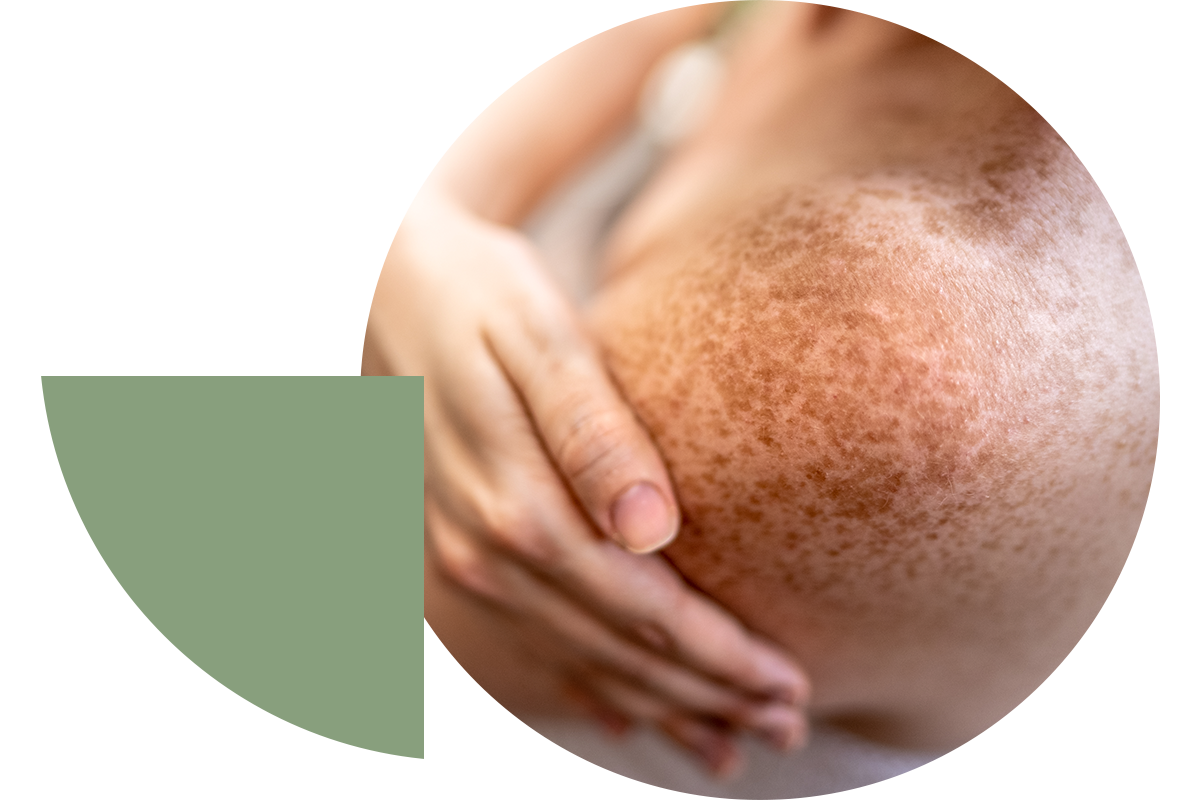 Des soins de peau adapt&eacute;s selon les saisons