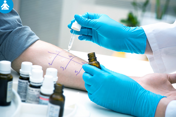 Les allergies graves et l&rsquo;anaphylaxie